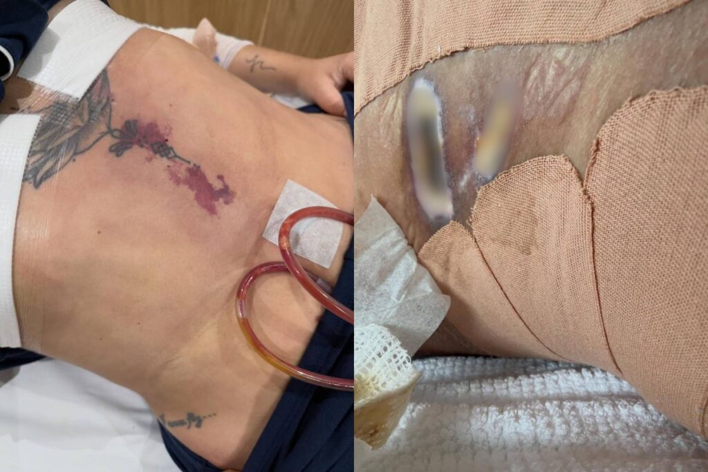 dentista-denuncia-“clinica-das-estrelas”-apos-sepse-e-fotos-chocam