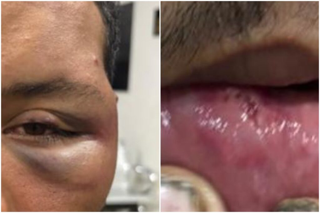 petista-e-espancado-em-bar-apos-revelar-partido-politico