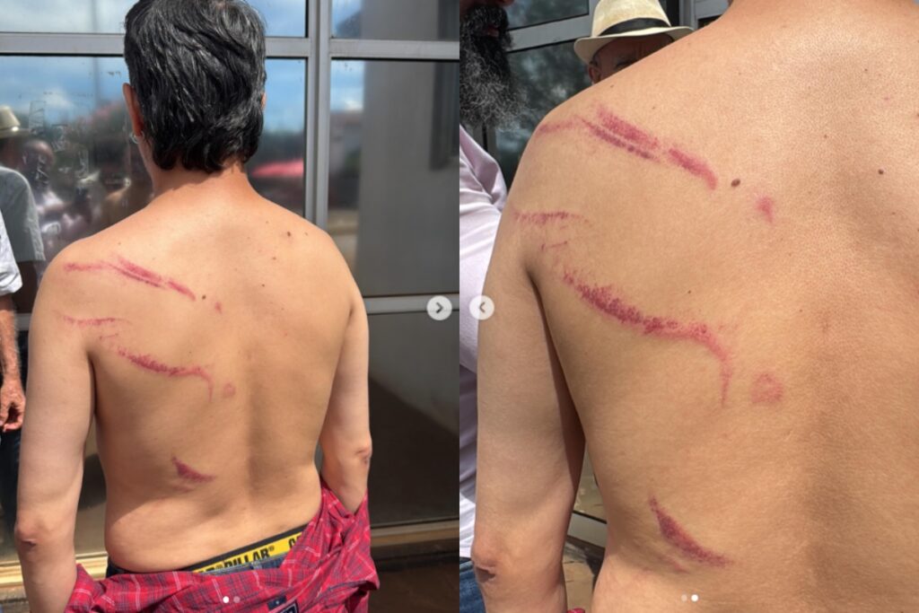 vereador-do-pt-preso-em-ato-do-mst-acusa-pmgo-de-agressao-fisica