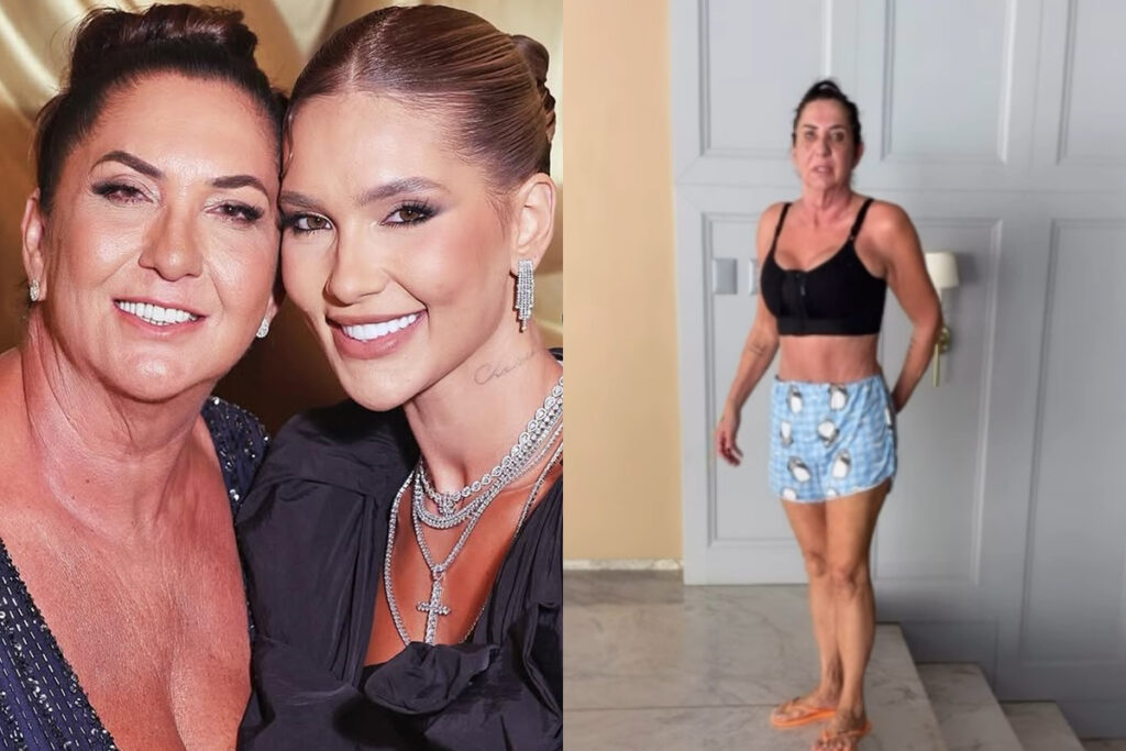 virginia-exibe-novo-visual-da-mae-apos-serie-de-cirurgias.-veja-video