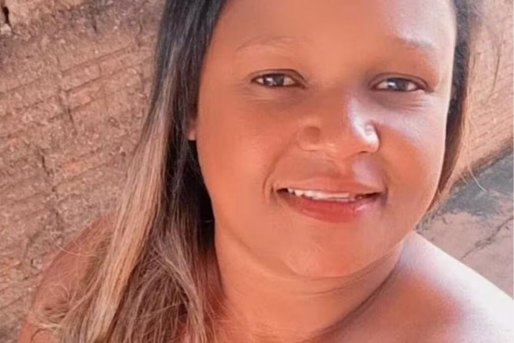 morre-mulher-que-teve-corpo-queimado-pelo-ex-companheiro-em-sp