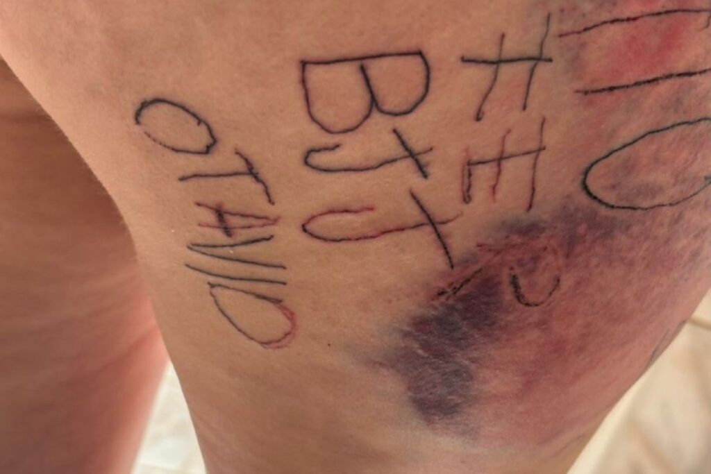 mulher-e-torturada-e-tatuada-a-forca-por-companheiro.-imagens-fortes