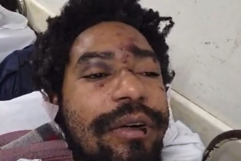 ator-e-internado-apos-sofrer-ataque-homofobico-em-adega-em-sao-paulo