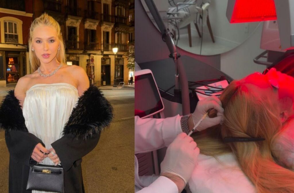 queda-de-cabelo-em-virginia-fonseca:-sabe-o-que-causa-a-alopecia