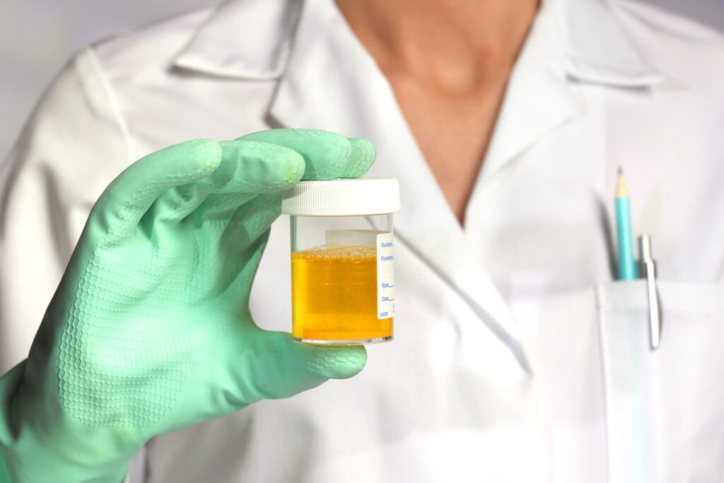 nefrologista-aponta-6-sinais-no-xixi-que-indicam-problemas-de-saude