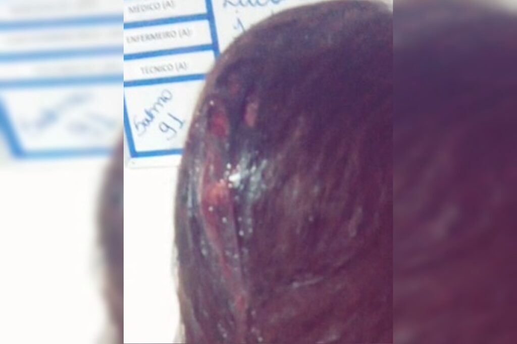 mulher-e-apedrejada-e-foge-de-agressor-no-df:-“vou-te-matar”