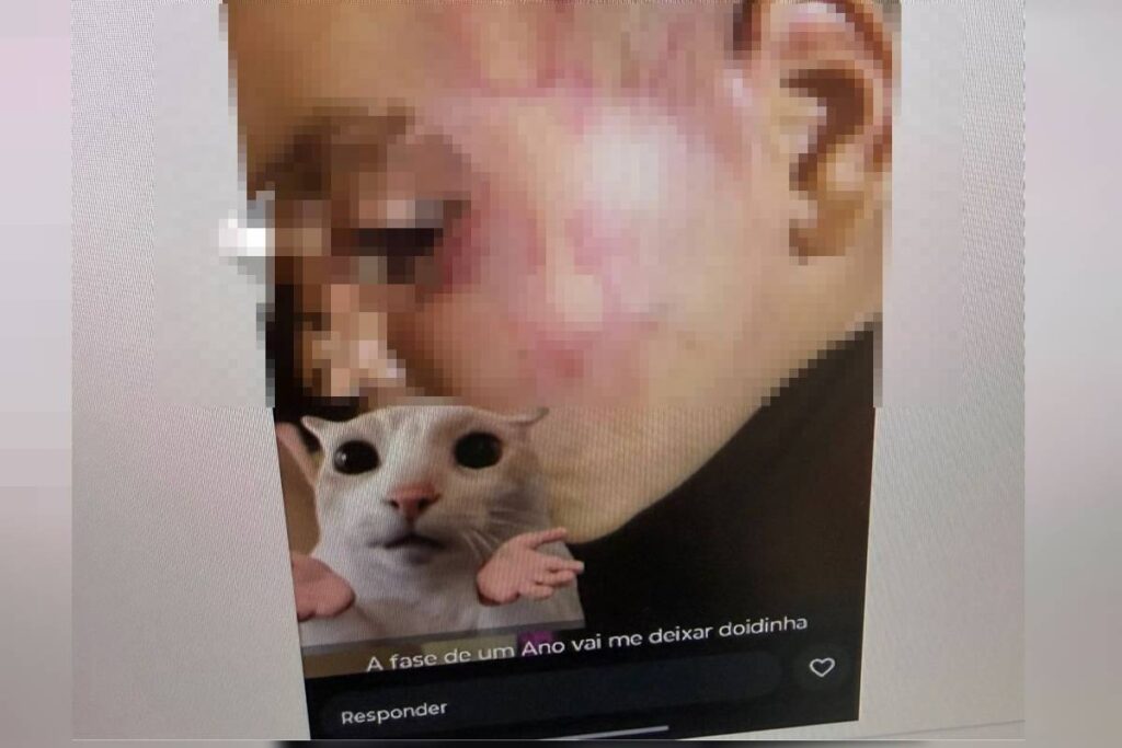 mae-posta-foto-de-filho-espancado-e-padrasto-e-preso:-“a-fase-de-1-ano-vai-me-deixar-doida”