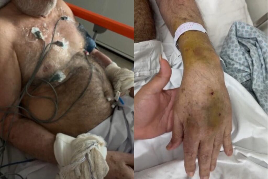 paciente-e-amarrado-em-hospital-do-df-e-familia-cobra-respostas