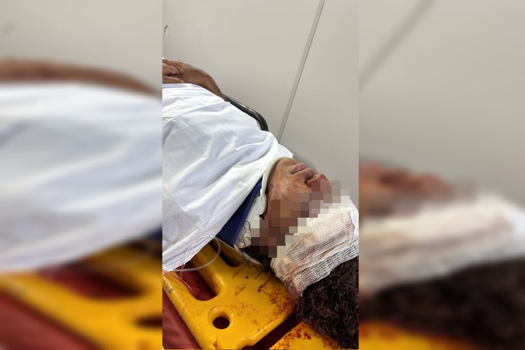 imagens-mostram-momento-em-que-motorista-atropela-mulher-no-df-e-foge.-veja-video