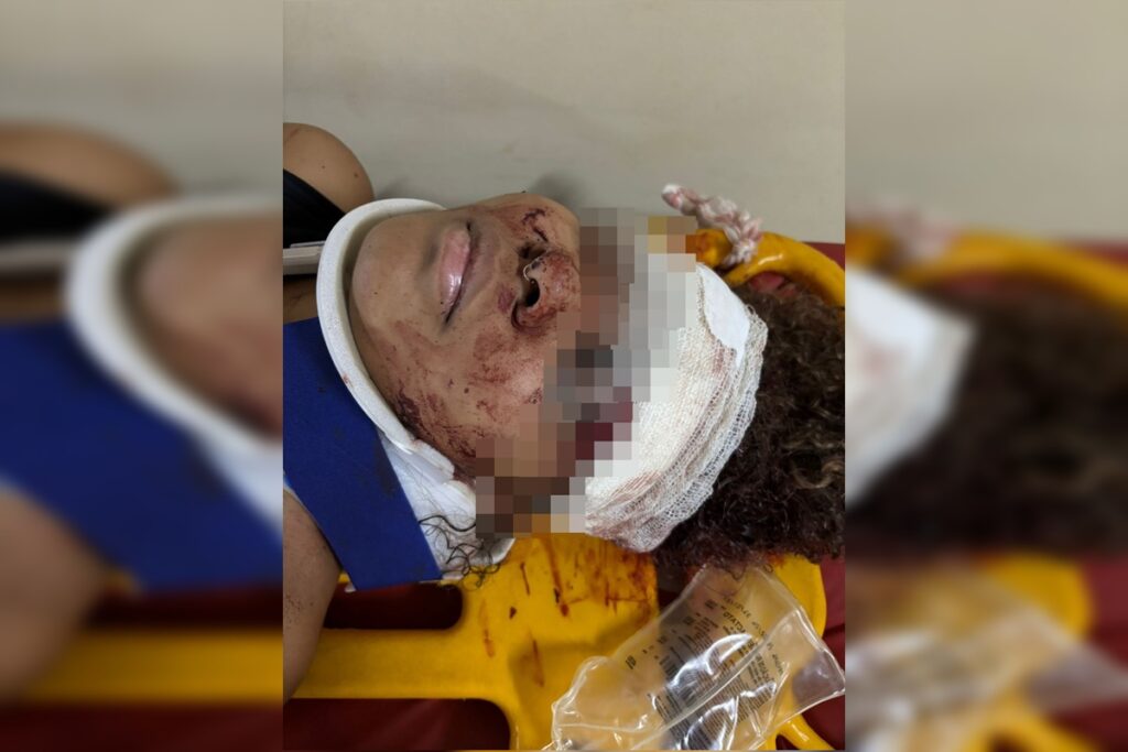 testemunha-gritou-para-motorista-que-atropelou-jovem-parar-de-dar-re