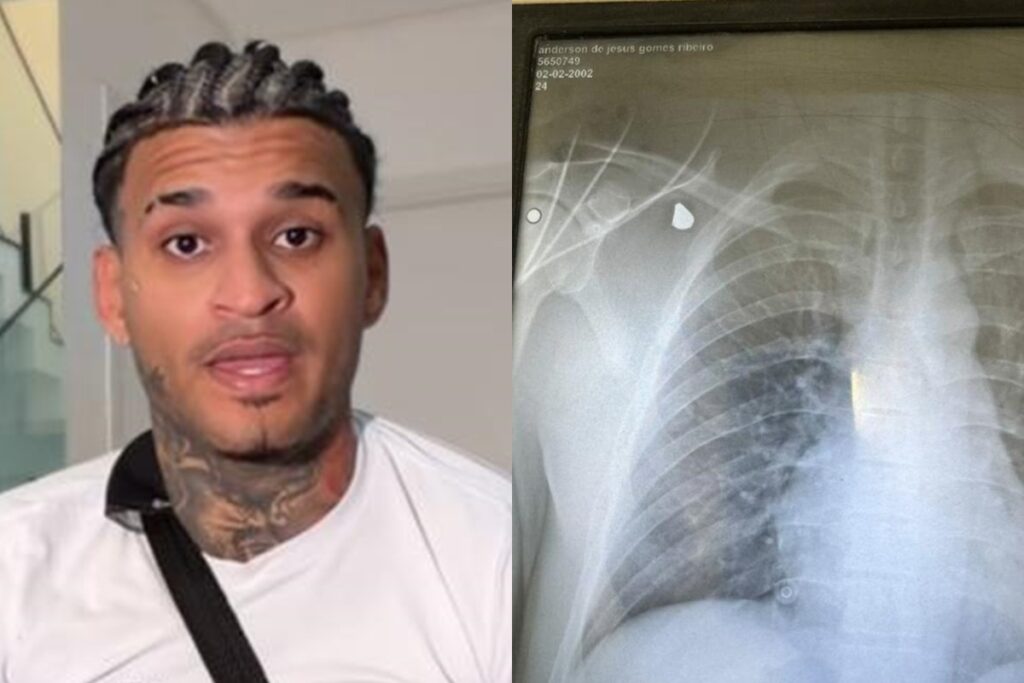 anderson-neiff-atualiza-estado-de-saude-apos-ser-baleado-em-sao-paulo
