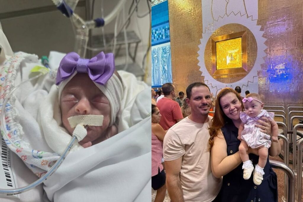 bebe-de-624-g-vence-os-1%-de-chance-de-vida-e-e-batizada-em-aparecida