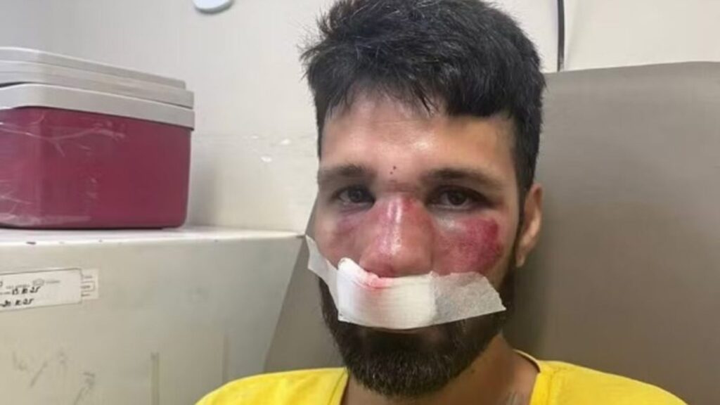 dj-e-espancado-ao-ser-confundido-com-ladrao-no-dia-do-seu-aniversario