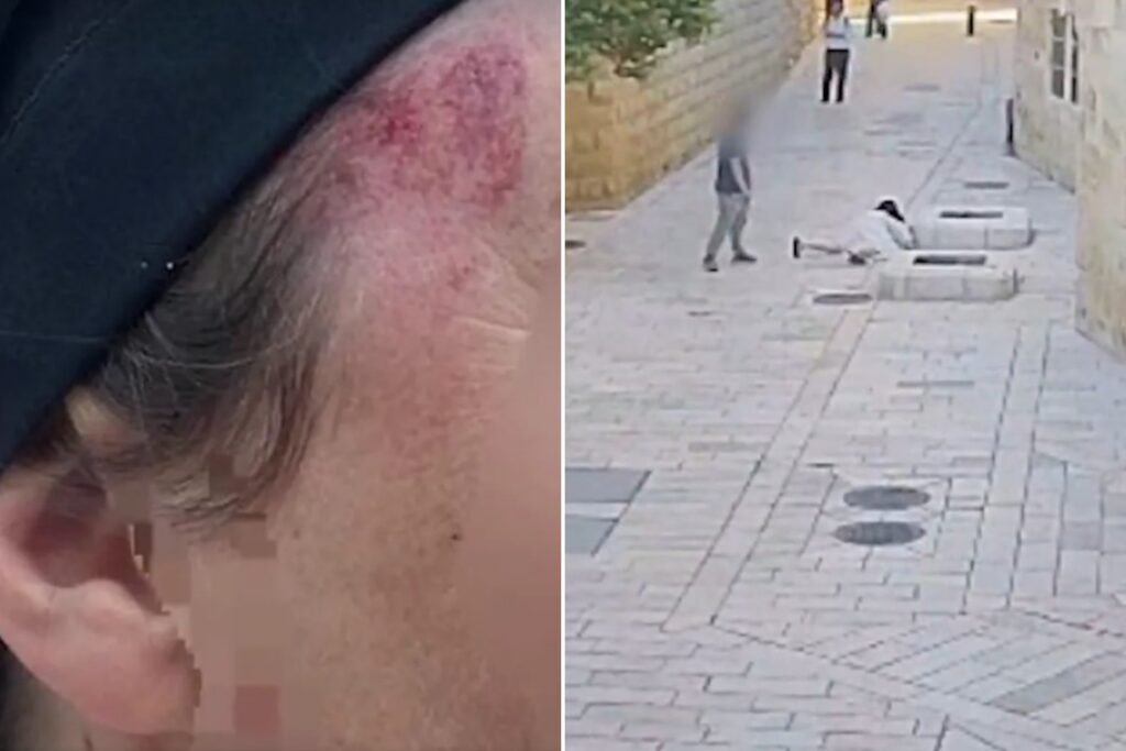 homem-e-preso-apos-derrubar-e-agredir-freira-em-jerusalem.-video