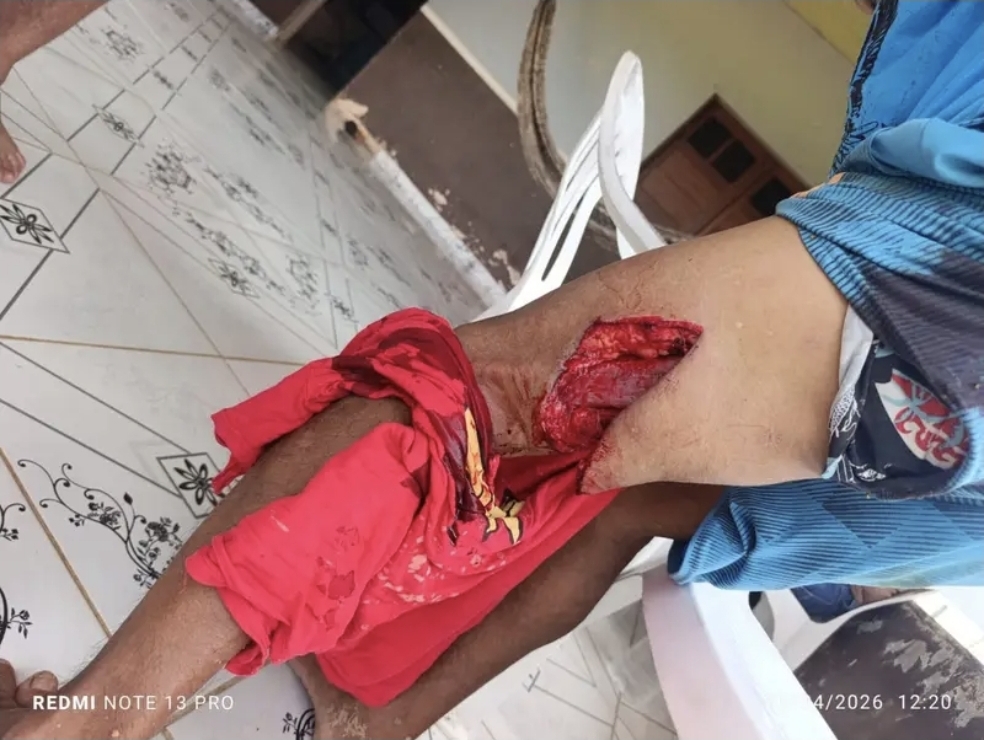 Ataque de boi deixa homem ferido gravemente na zona rural de Cruzeiro do Sul