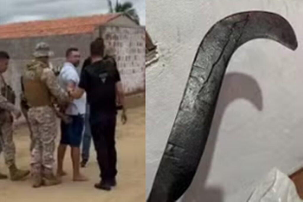 jovem-que-teve-maos-decepadas-por-ex-com-foice-passa-por-reimplante.-veja-video
