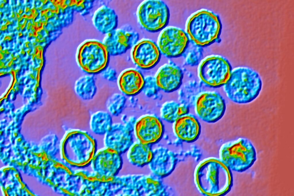 hantavirus:-transmissao-em-cruzeiro-e-entre-humanos,-diz-africa-do-sul