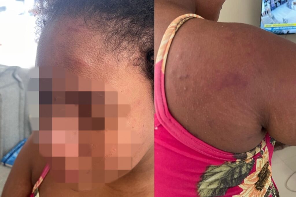 domestica-agredida-por-patroa-afirma-que-tentou-proteger-bebe