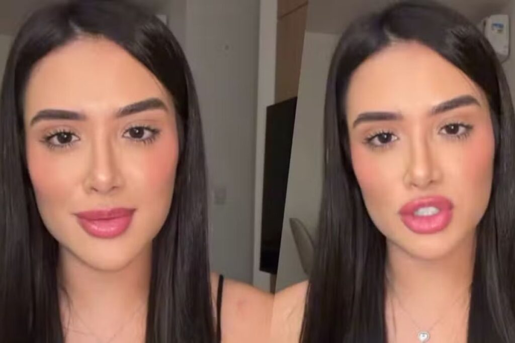 ex-bbb-jordana-usa-acido-hialuronico-para-hidratar-labios;-entenda