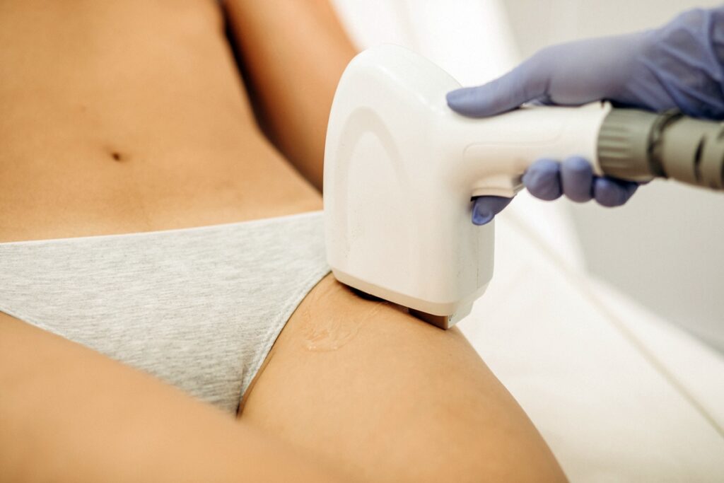 depilacao-intima-doi?-entenda-como-funciona-o-procedimento-com-laser