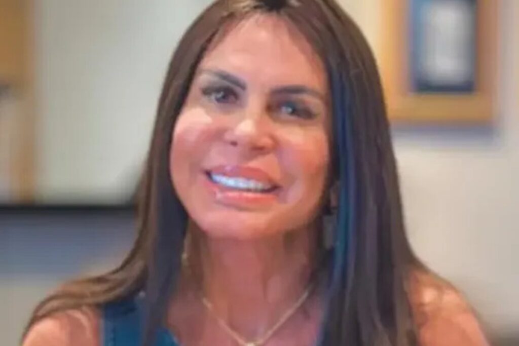 gretchen-aparece-sem-protese-capilar-e-revela-causa-de-sua-alopecia
