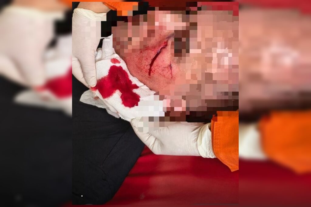 pm-e-atacado-com-telha-durante-ocorrencia-de-violencia-domestica