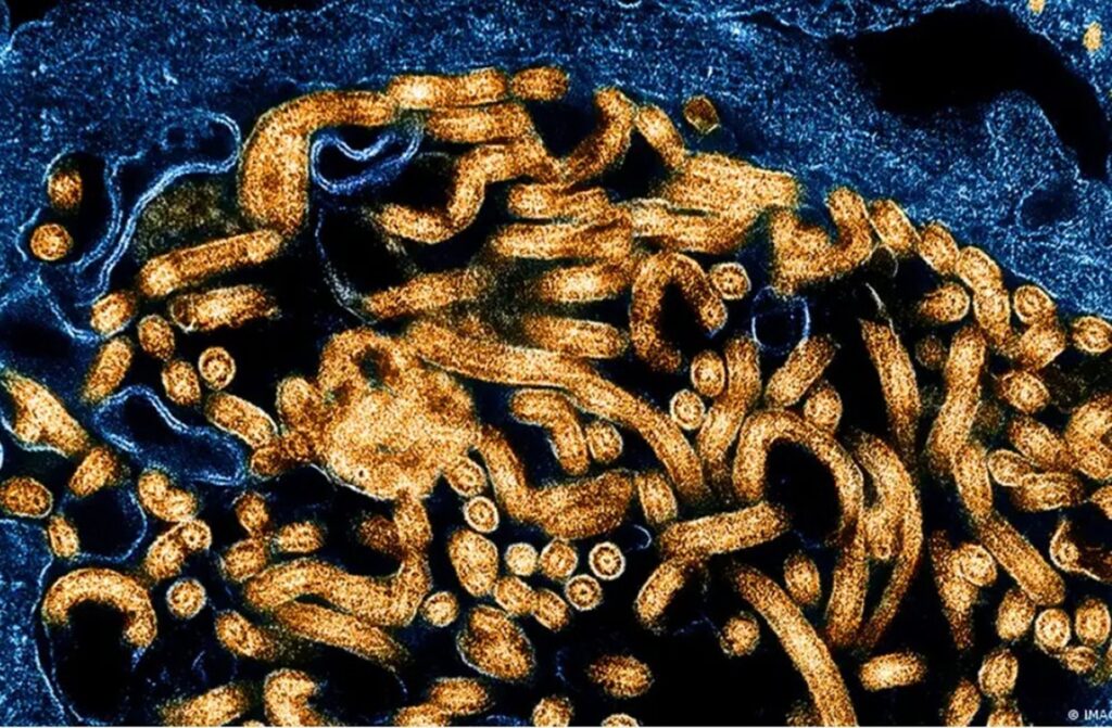 surto:-cdc-da-africa-confirma-395-casos-de-ebola-e-106-mortes