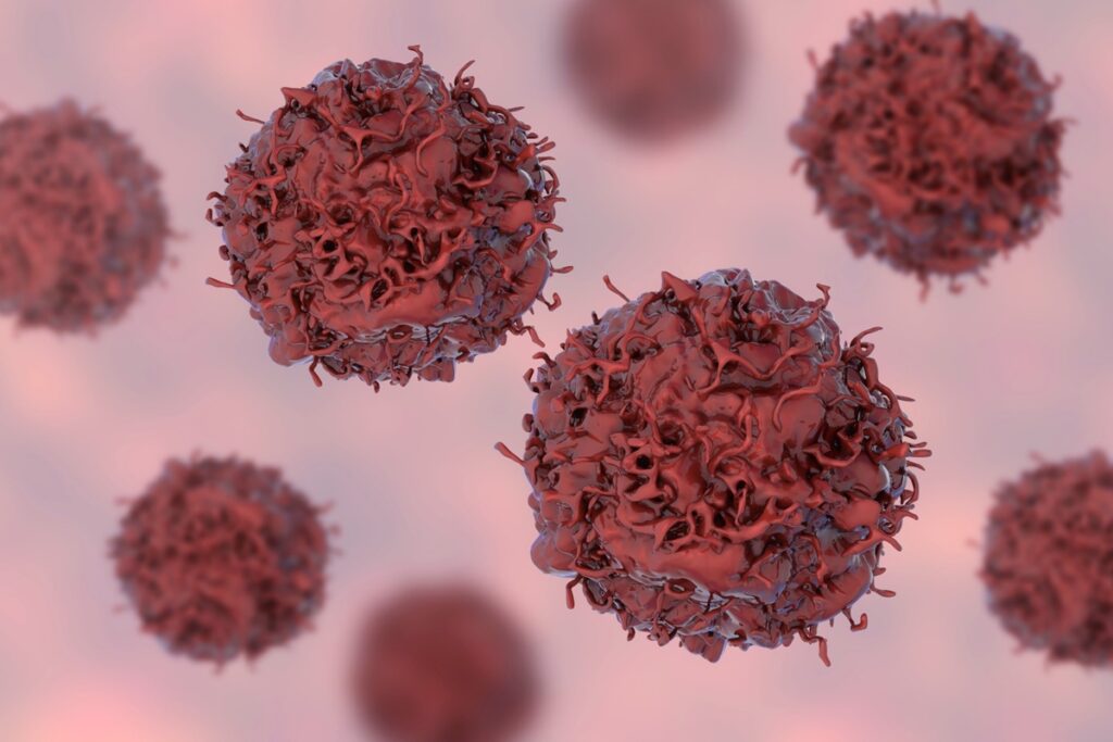 multiomica-amplia-precisao-no-diagnostico-e-tratamento-do-cancer