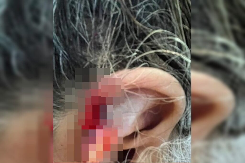 neto-arranca-e-engole-pedaco-da-orelha-da-avo-durante-agressao