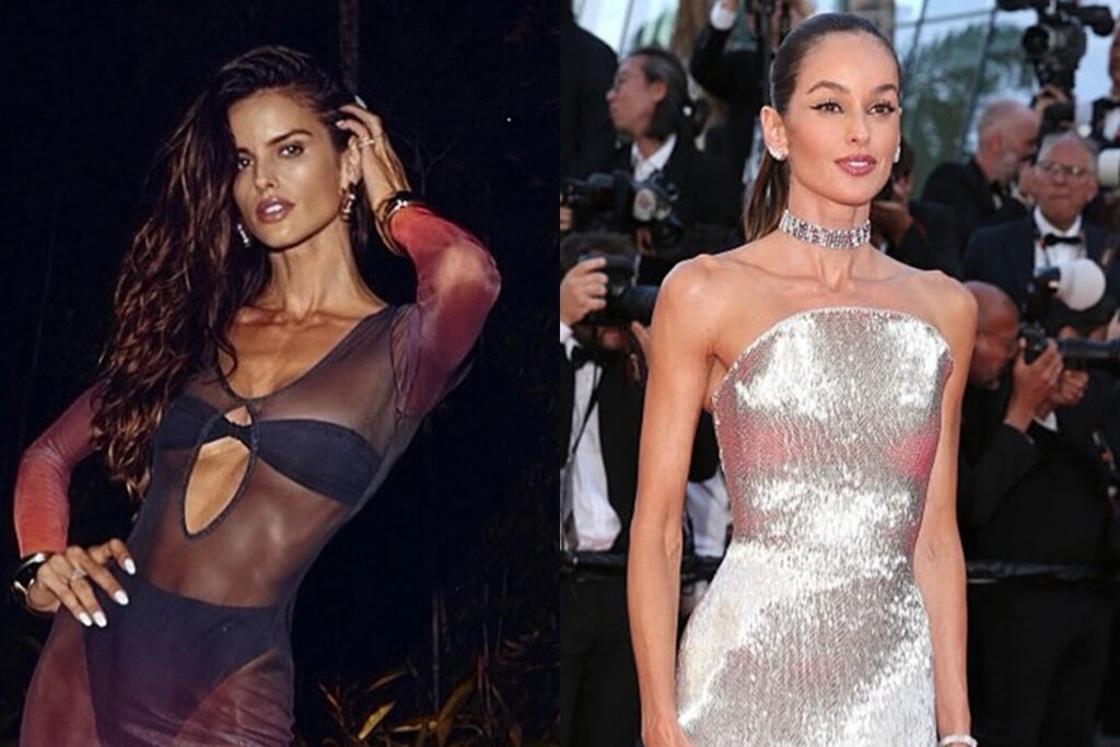 izabel-goulart-surge-irreconhecivel-em-cannes-e-medico-avalia-mudancas