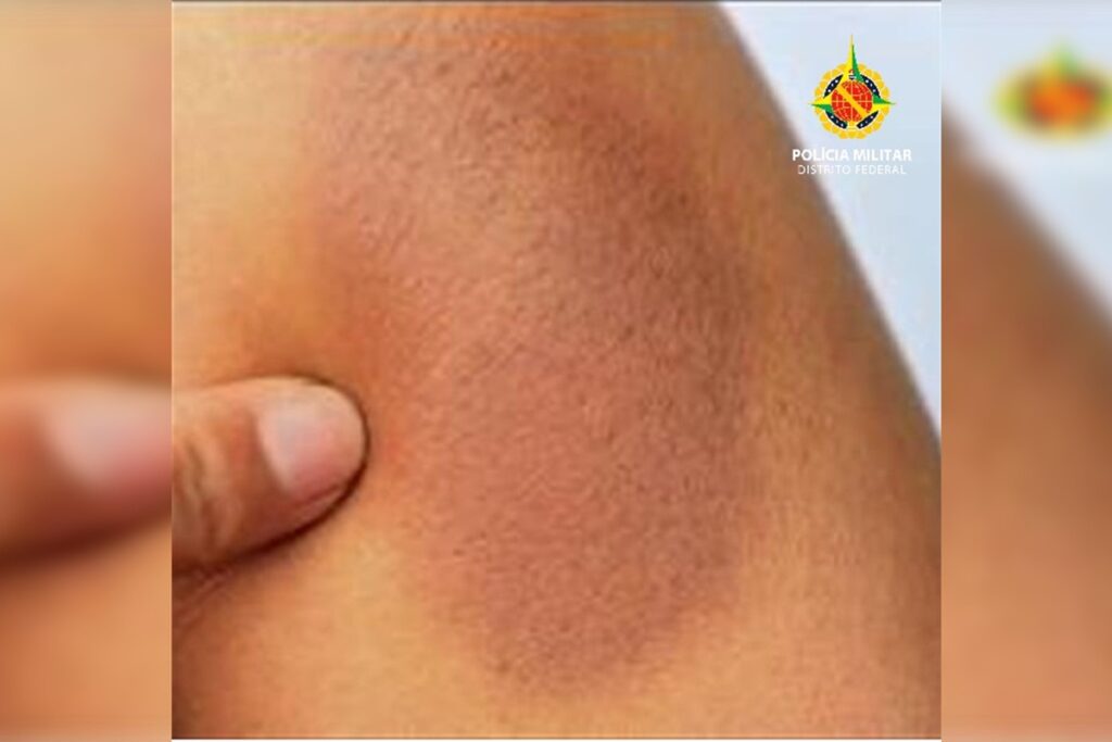 df:-agressivo,-homem-e-preso-apos-quebrar-onibus-e-bater-em-passageira