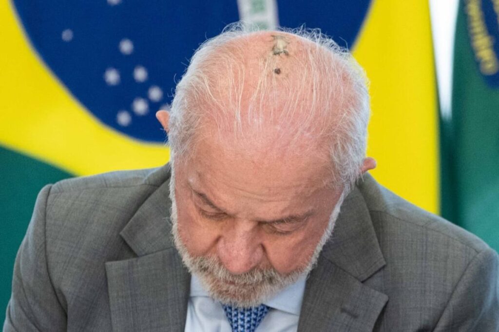 lula-faz-novas-sessoes-de-radioterapia-no-couro-cabeludo