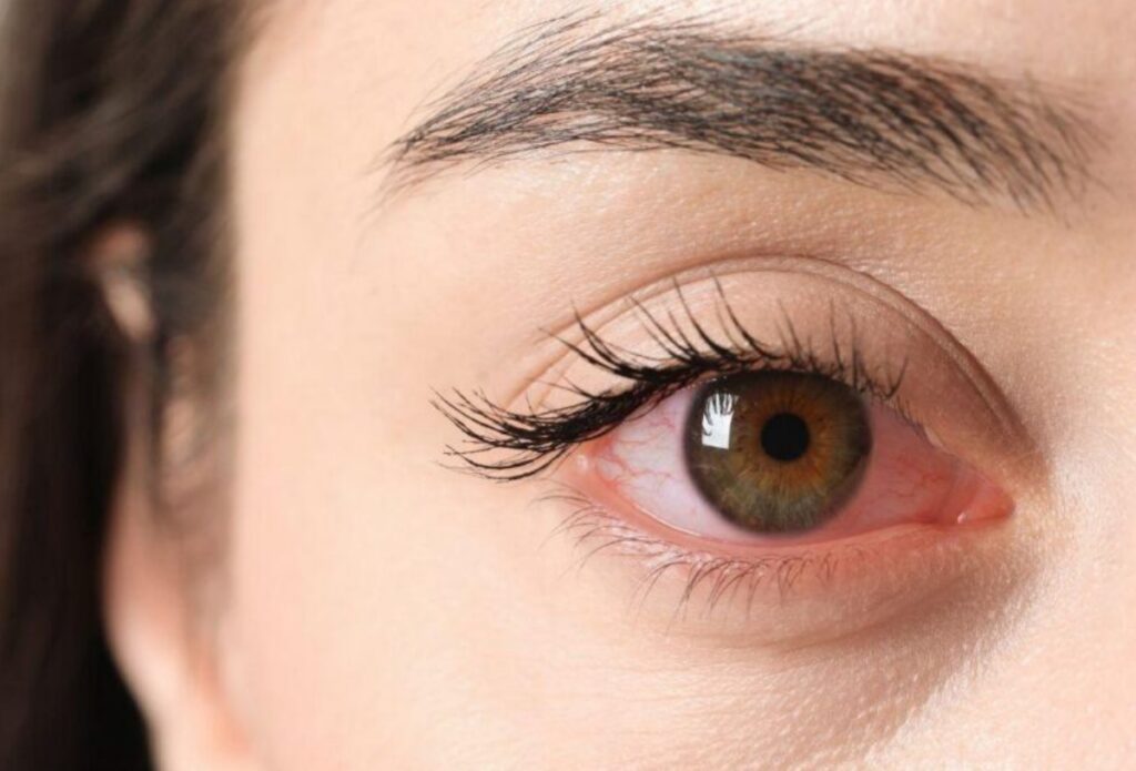 visao-embacada?-veja-como-proteger-a-saude-dos-olhos-com-a-alimentacao