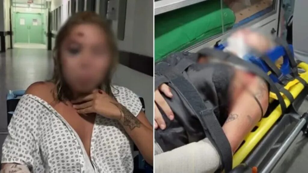passageira-diz-ter-sido-atropelada-por-motorista-de-app-apos-discussao