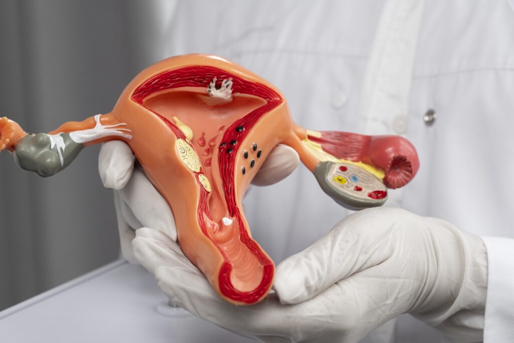 dna-hpv:-exame-para-rastrear-cancer-de-colo-do-utero-chega-a-59-ubss