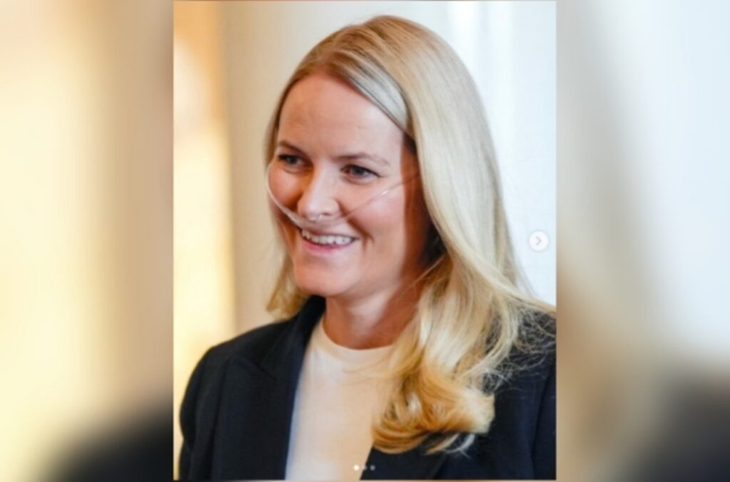 princesa-da-noruega-esta-em-lista-de-espera-para-transplante-de-pulmao
