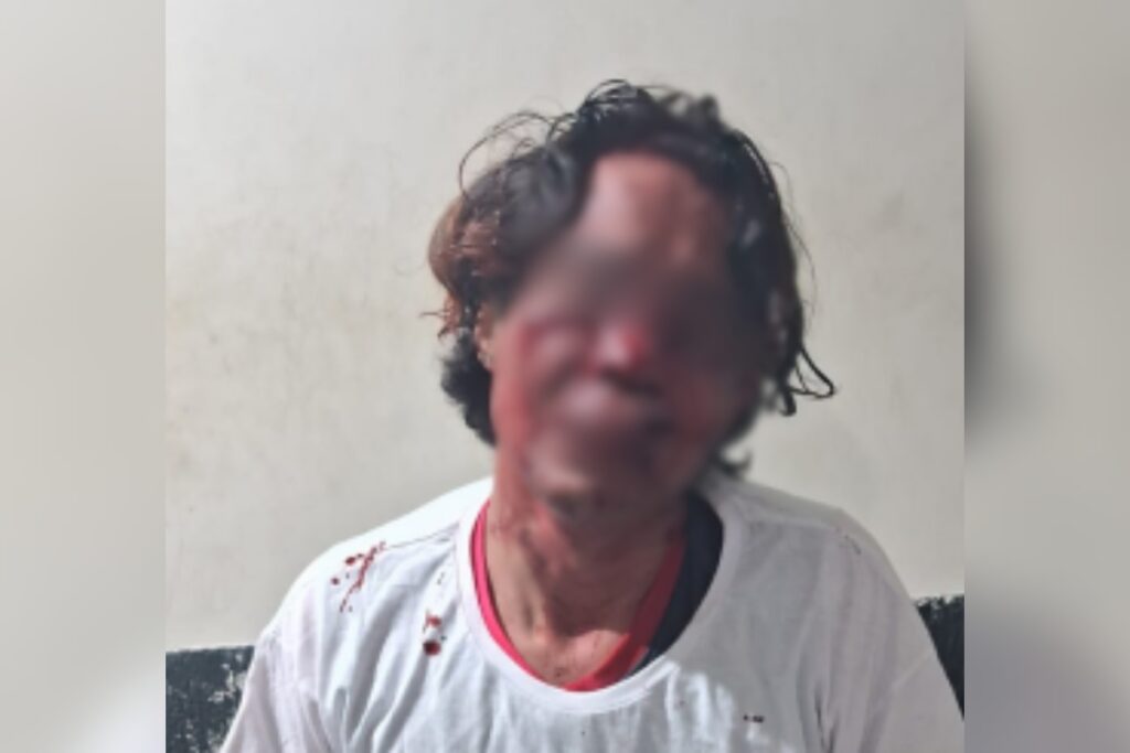 briga-de-casal-na-prisao-acaba-em-pancadaria-e-sangue-para-todo-lado