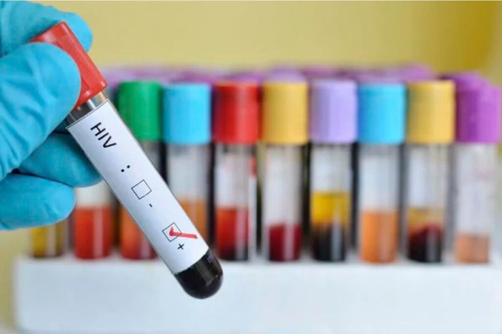 Quatro mulheres denunciaram dentista preso suspeito de transmitir HIV quatro-mulheres-denunciaram-dentista-preso-suspeito-de-transmitir-hiv