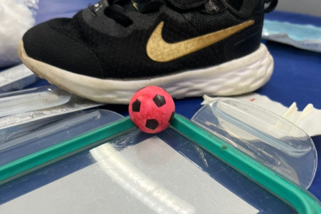 crianca-de-3-anos-engole-bolinha-de-plastico-e-tem-parada-respiratoria