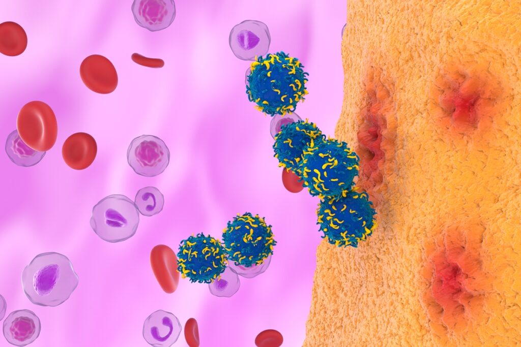 terapia-car-t-sera-testada-contra-lupus-e-miastenia-no-brasil