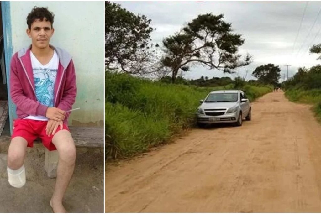 Servidor amputa a propria perna para aplicar golpe de R$ 1,5 milhão no seguro servidor-amputa-a-propria-perna-para-aplicar-golpe-de-r$-1,5-milhao-no-seguro