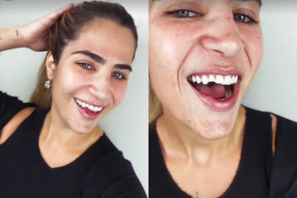 filha-de-leonardo-desmaia,-cai-e-quebra-o-dente