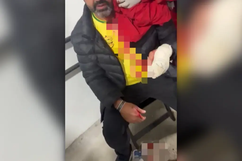 vereador-de-mg-e-acusado-de-agredir-homem-com-garrafadas-em-boate