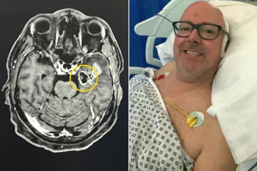 homem-confunde-tontura-com-abstinencia-e-descobre-tumor-cerebral