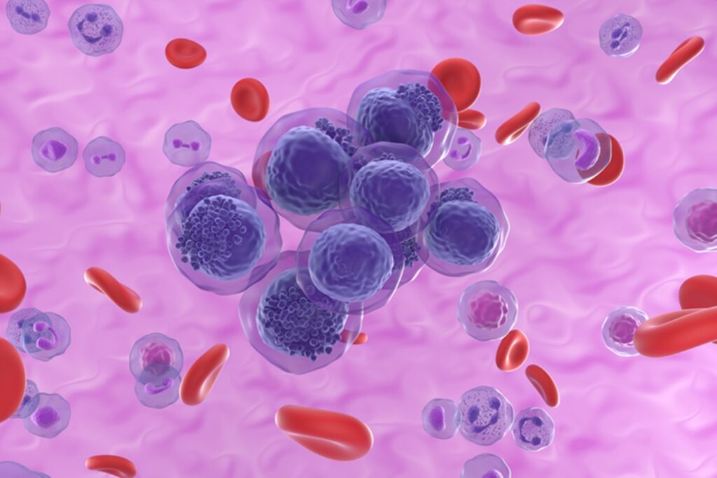 inca-estima-12,2-mil-novos-casos-de-leucemia-por-ano-no-pais-ate-2028