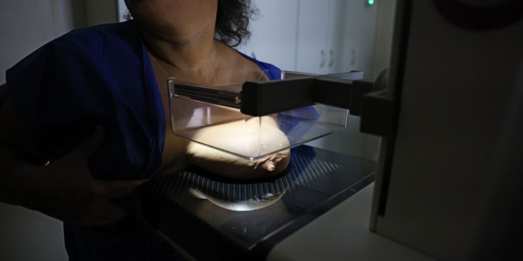ANS defende que plano cubra mamografia digital sem restrição de idade ans-defende-que-plano-cubra-mamografia-digital-sem-restricao-de-idade