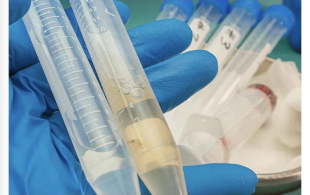 Cruzeiro do Sul registra 6 dos 10 casos de meningite no AC em 2026