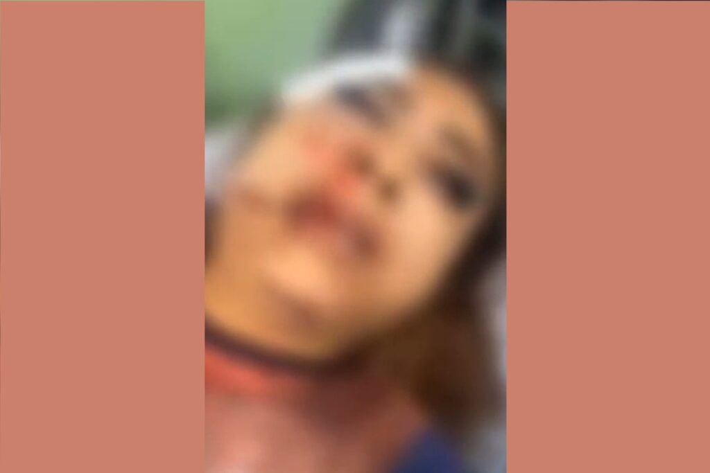 Garota de programa tem rosto desfigurado ao ser agredida por cliente garota-de-programa-tem-rosto-desfigurado-ao-ser-agredida-por-cliente