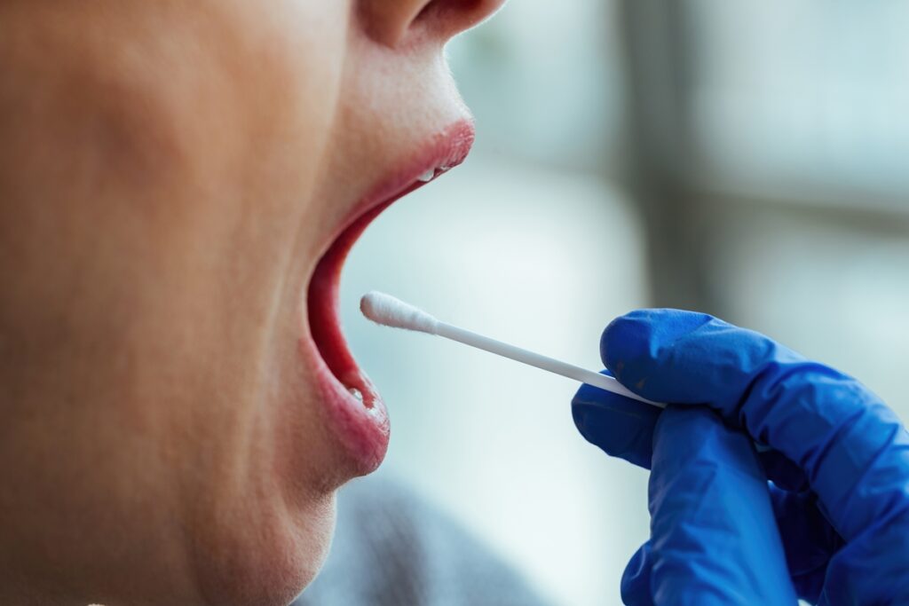 Novo teste com cotonete pode detectar câncer de boca em uma hora novo-teste-com-cotonete-pode-detectar-cancer-de-boca-em-uma-hora