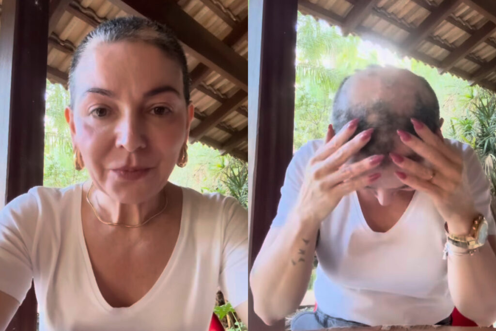 mae-de-lucas-lucco-desabafa-ao-anunciar-a-volta-da-alopecia-areata